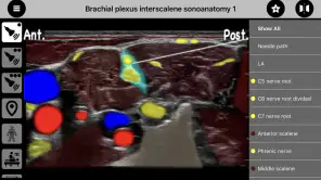 AnSo Anaesthesia Sonoanatomy screenshot 1