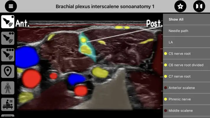 AnSo Anaesthesia Sonoanatomy screenshot 1