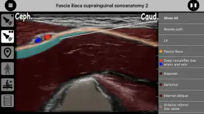 AnSo Anaesthesia Sonoanatomy screenshot 4